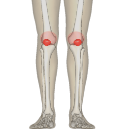 patellofemoral pain knee cap pain exercises