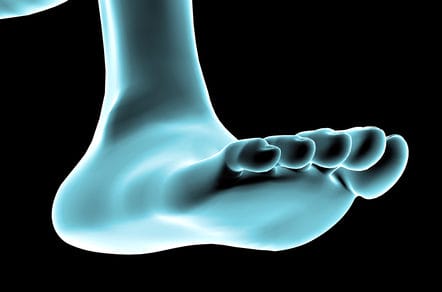 windlass mechanism. improtant for understanding plantar fasciitis