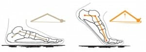Windlass mechanism, heel pain - self treatment and exercises