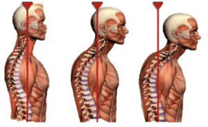 bad posture and why it causes headaches