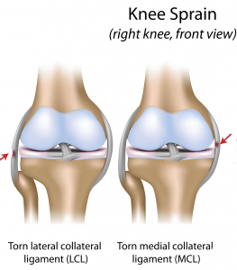 Sprained knee, heal fast and strong