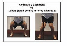 poor glut activation - how to improve gluts and posture