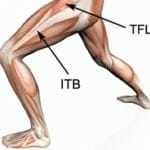 ITB syndrome