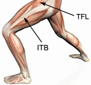 ITB syndrome