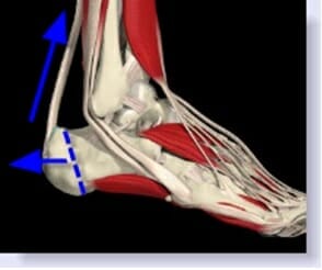 Sever's Disease: What, Why And How You Can Improve - Physio Prescription