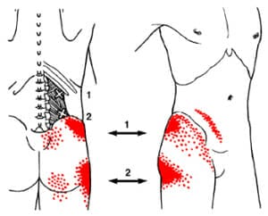 Strengthen Quadratus lumborum