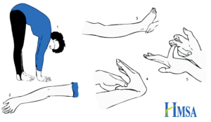 beighton-hypermobility-score