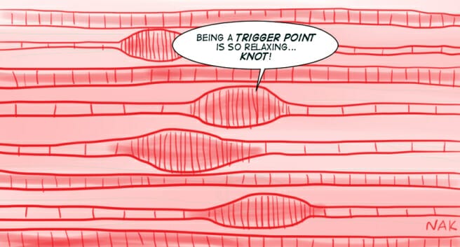 Muscle knots, self release